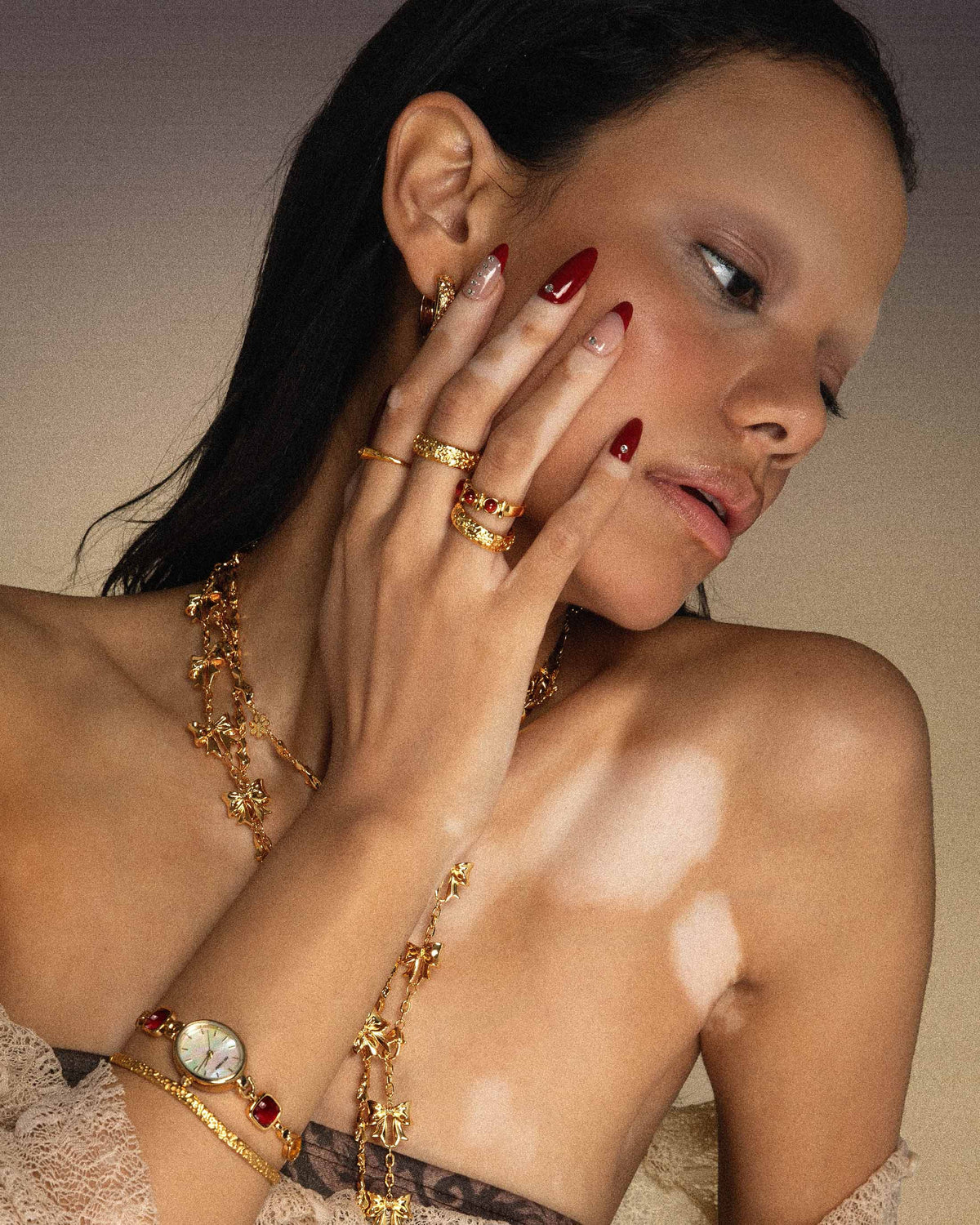 Serenade of Butterfly Orchid Ring